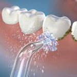 歯科フロス vs. Waterpik™ウォーターフロッサー:よくある誤解と真実