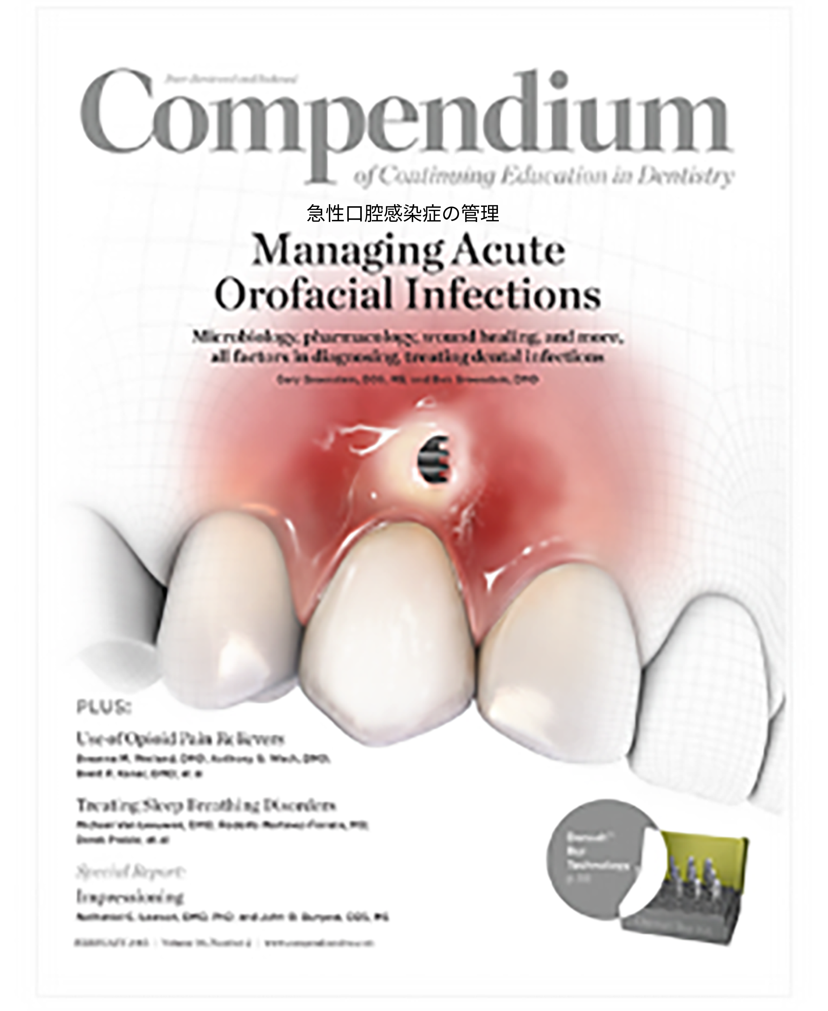 Waterpik™ウォーターフロッサーの安全性に関する包括的文献レビュー:50年以上の臨床研究による実証