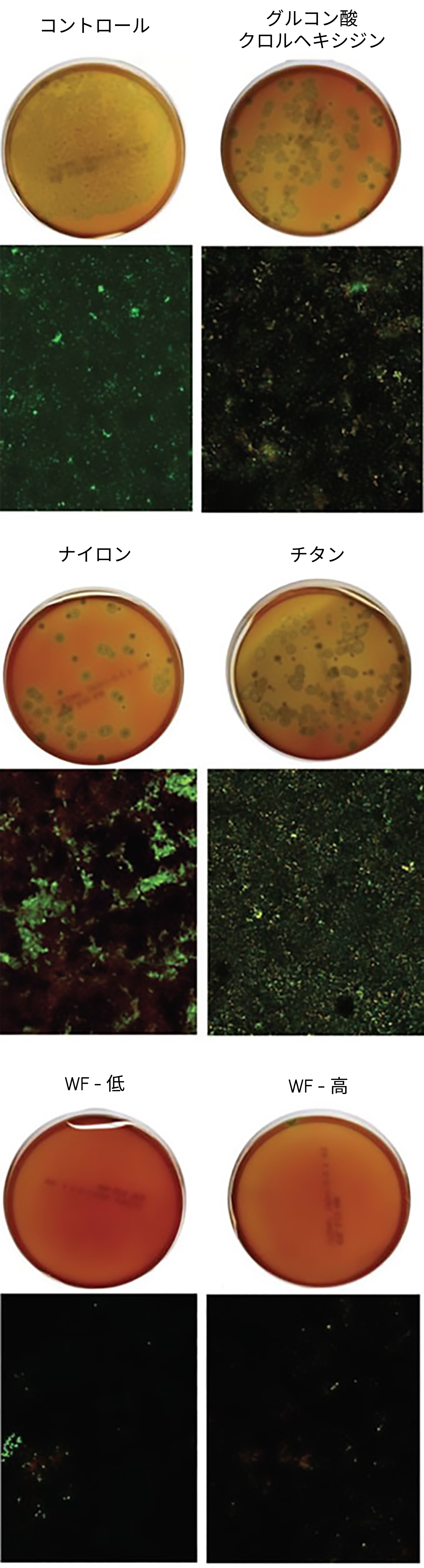 Waterpik™ウォーターフロッサー:歯科インプラント表面の細菌除去効果に関する研究