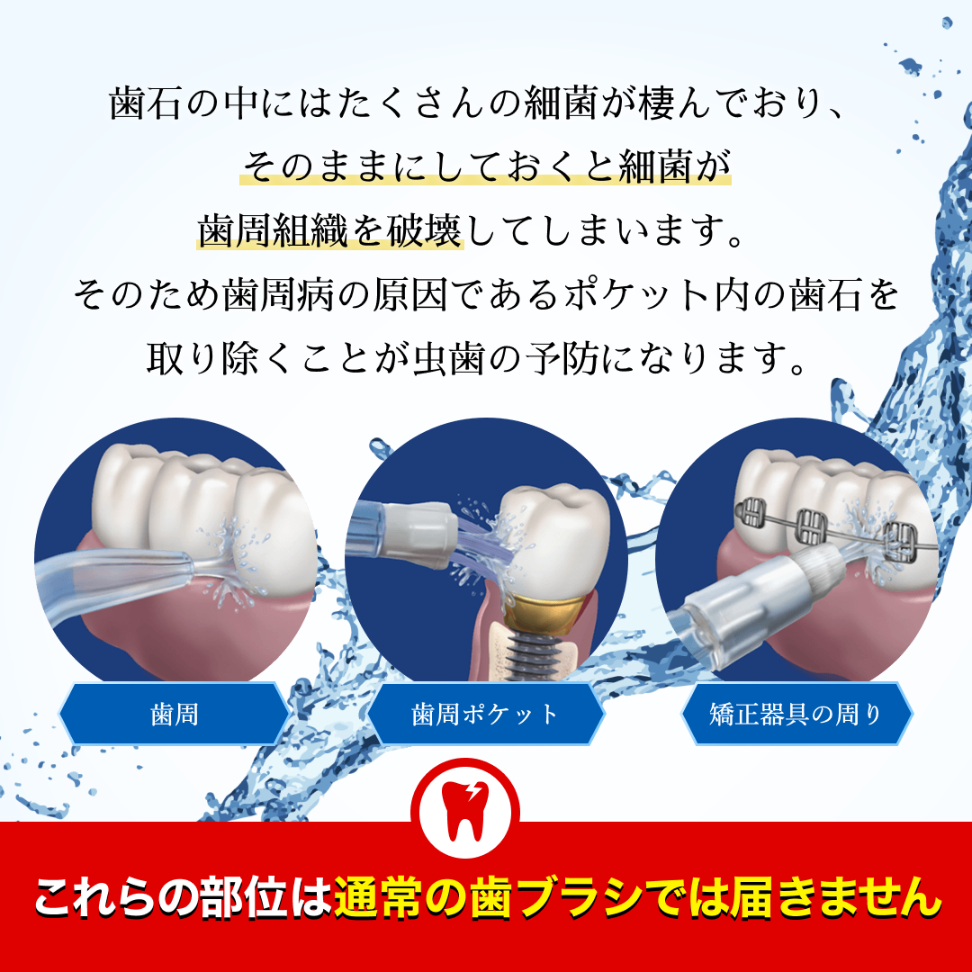 WF-10 コードレス セレクト