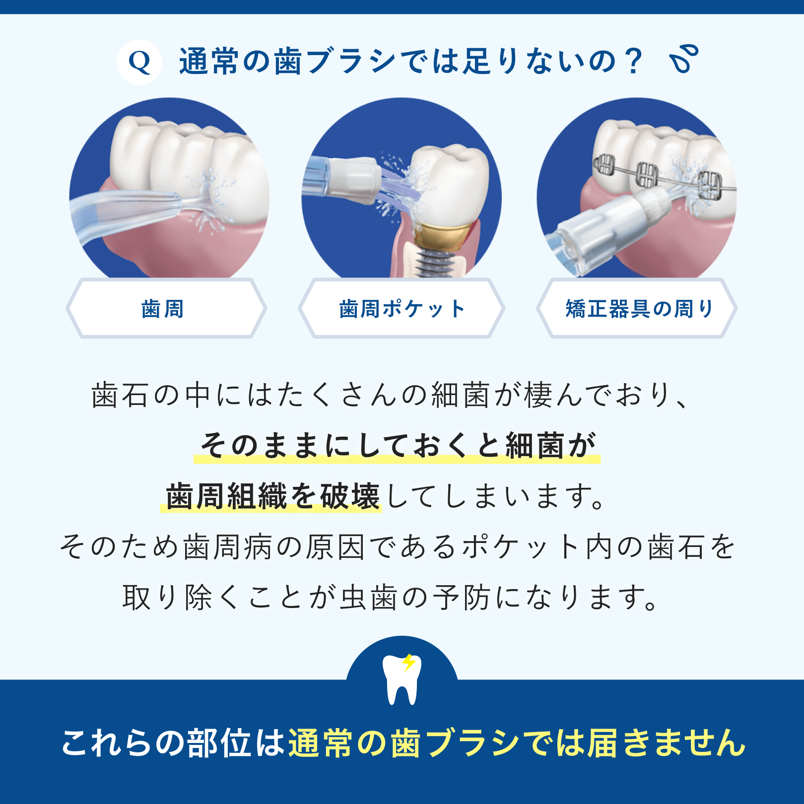 WF-10 コードレス セレクト